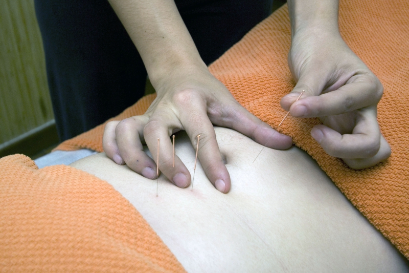 osteopathe-LANTOSQUE-min_acupuncture-4175625